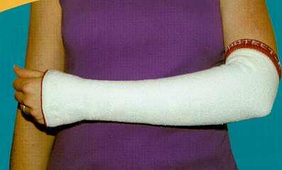 Protect-A-Limb