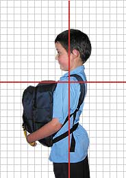 Profero Bag Posture