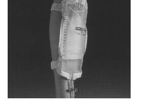 Trident Leg Bag