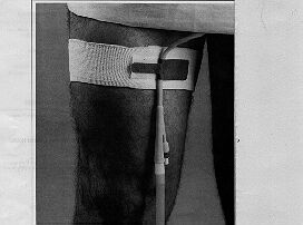 Dale Catheter Holder