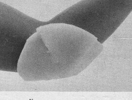 Self Adhering Elbow Pad