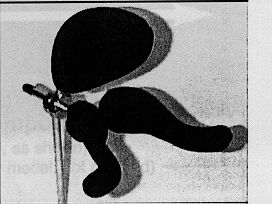 Head Support System