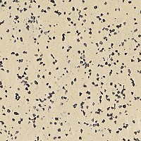 Stonetex